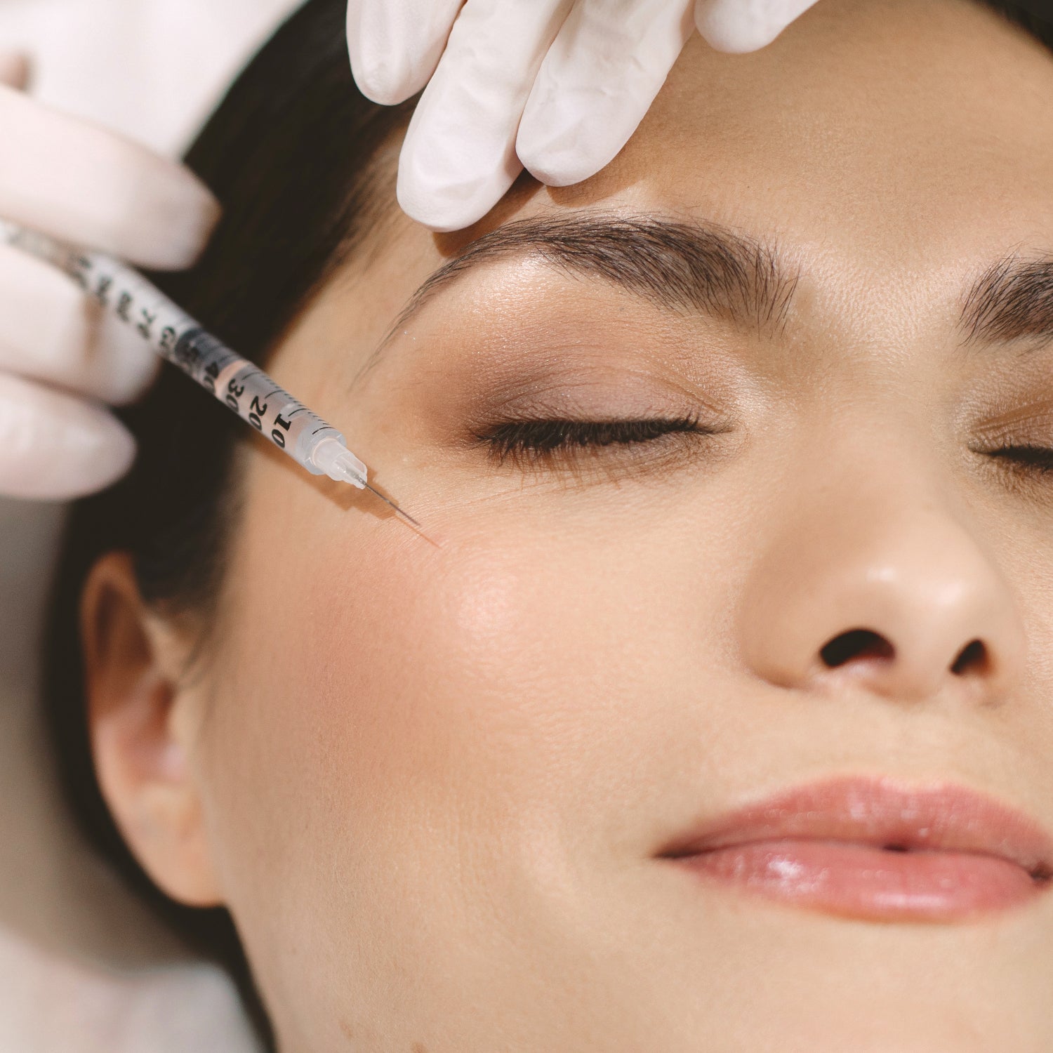 Image representing Facial Fillers