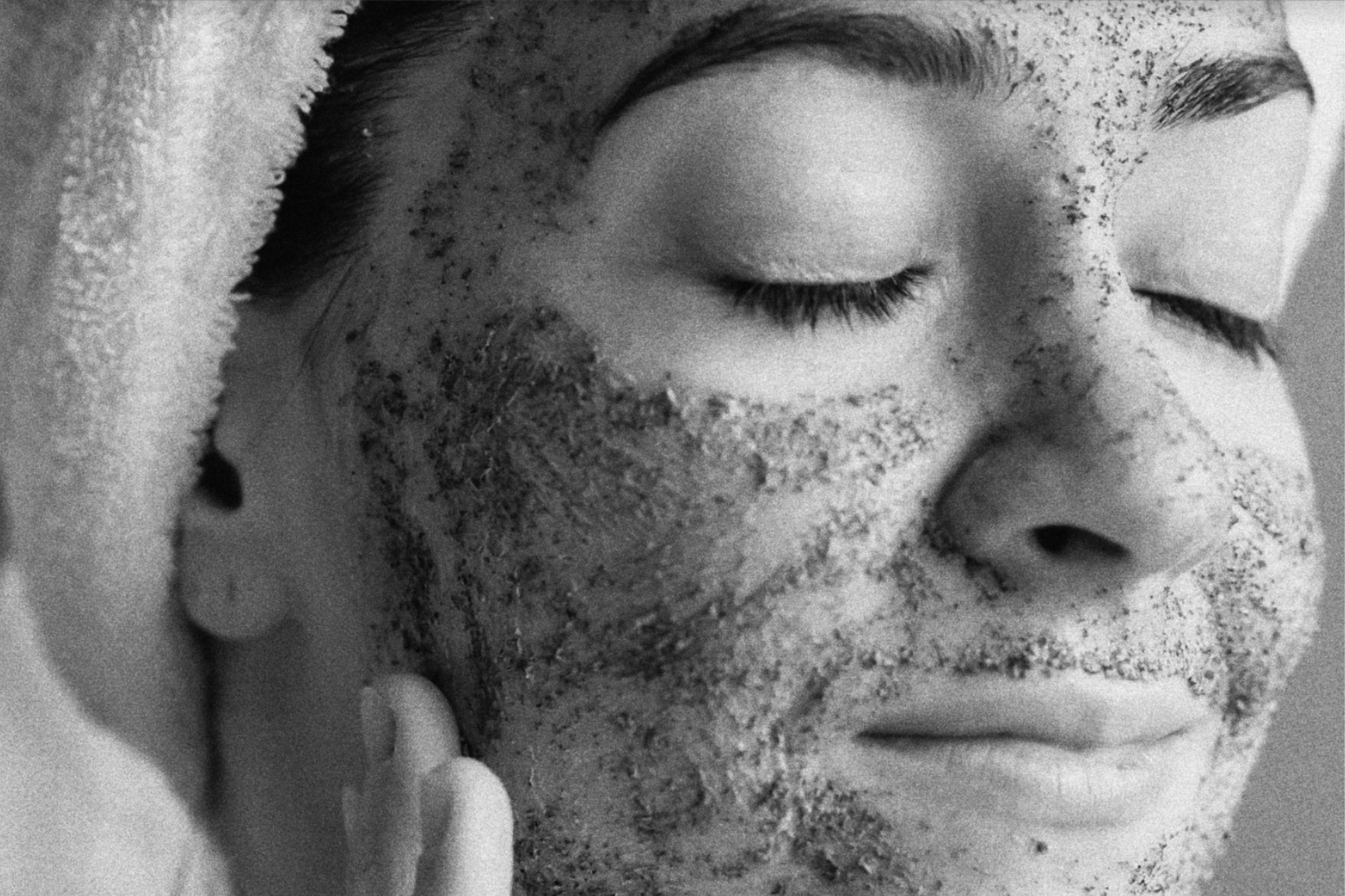 4 Ways You’re Treating Acne Wrong
