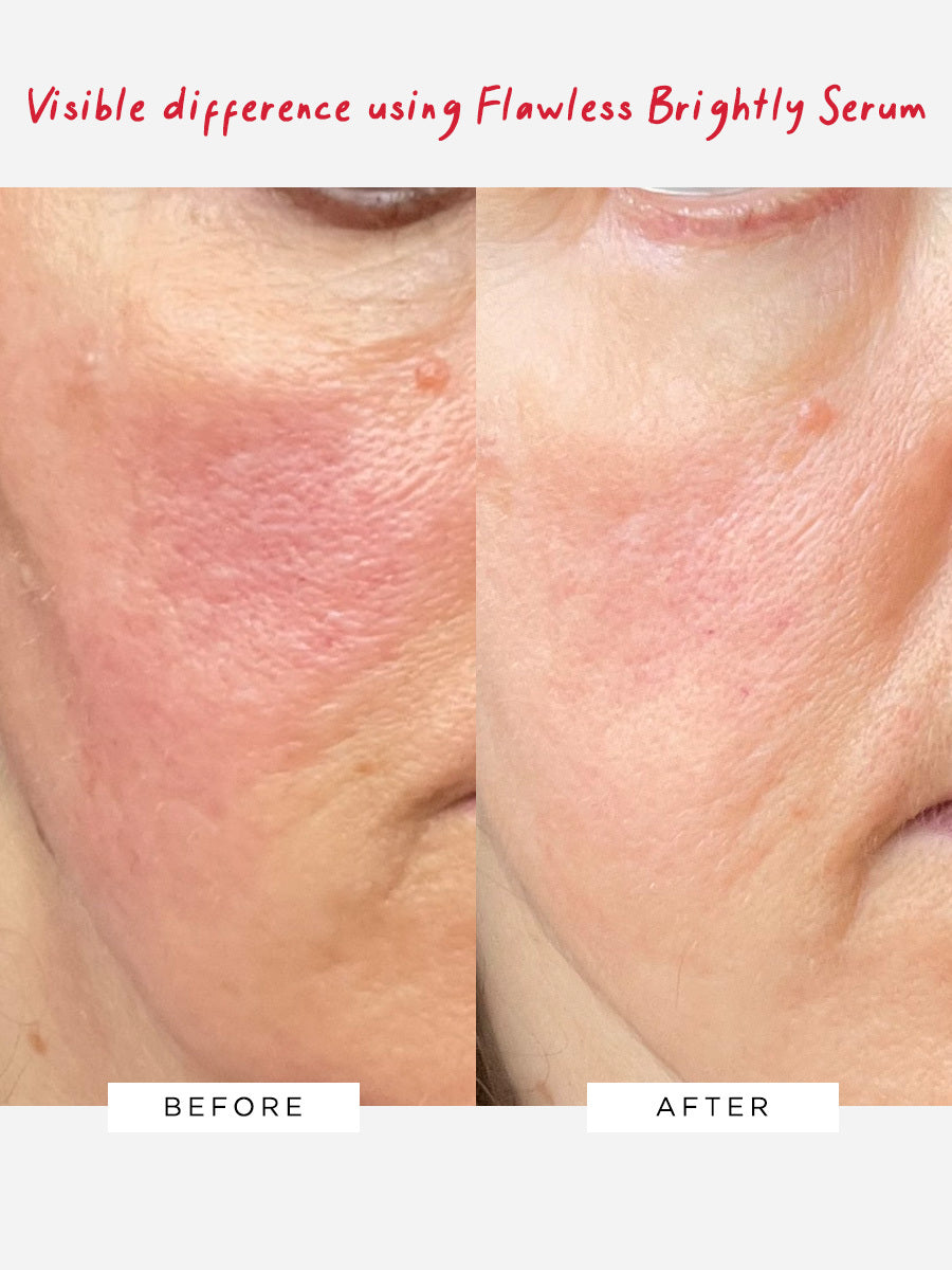 Dr Sam's Visible Results With Flawless Brightly Serum