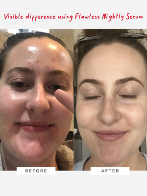 Dr Sam's Visible Results With Flawless Nightly 2% Retinoid Serum